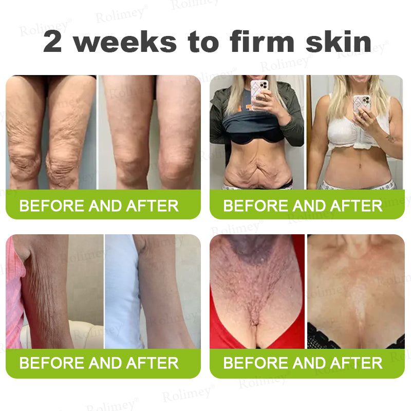 ✨👨‍⚕️Made and shipped from the USA 💫Rolimey® Botox & Vita-A Retinol Shot Wrinkle-Lift Tightening cream - Last Day Promotion 70% OFF