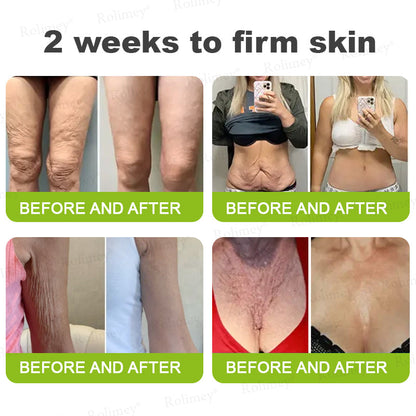 ✨👨‍⚕️Made and shipped from the USA 💫Rolimey® Botox & Vita-A Retinol Shot Wrinkle-Lift Tightening cream - Last Day Promotion 70% OFF