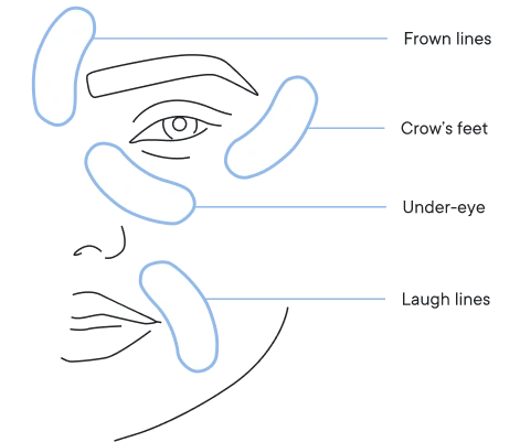 🔥Christmas Special Offer:80%OFF &Smooth, firm and plump stubborn areas with Micro-Infusion Targeted Patches