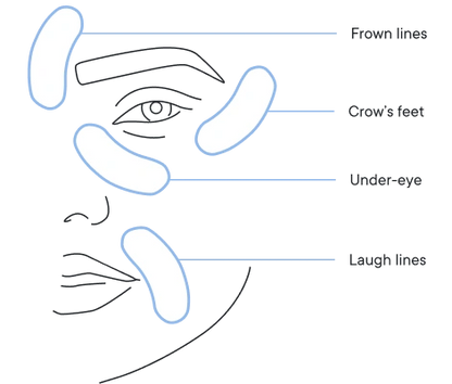 🔥Christmas Special Offer:80%OFF &Smooth, firm and plump stubborn areas with Micro-Infusion Targeted Patches