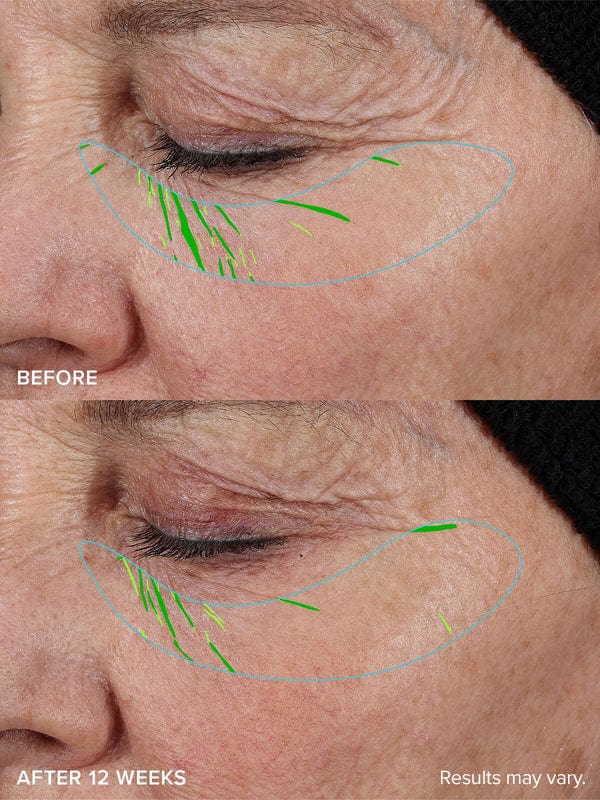 Last day 50% OFFRestore Firmness in Just 3 Weeks — Glow Confidently Without Makeup!