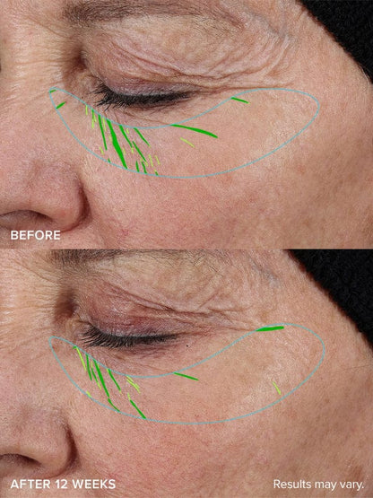 Last day 50% OFFRestore Firmness in Just 3 Weeks — Glow Confidently Without Makeup!